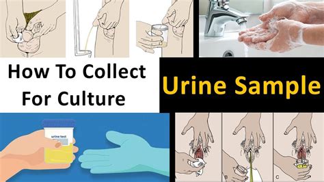 taking urine sample at home